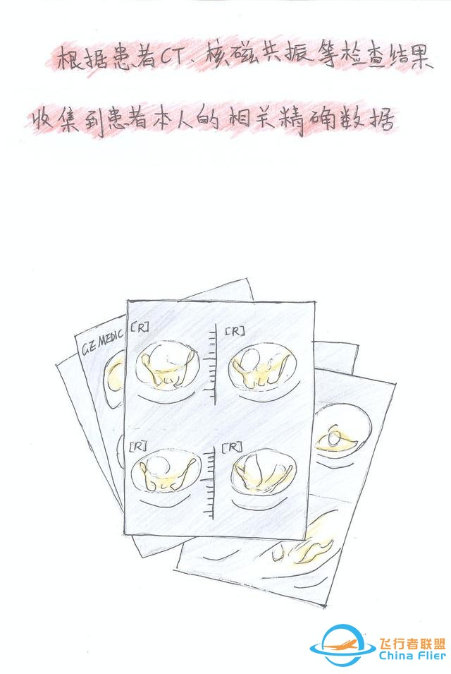 醫(yī)學(xué)領(lǐng)域的“AR 3D”技術(shù)究竟有多炫？10幅手繪漫畫給你講透-7025