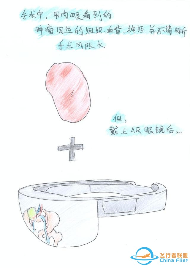 醫(yī)學(xué)領(lǐng)域的“AR 3D”技術(shù)究竟有多炫？10幅手繪漫畫給你講透-7249