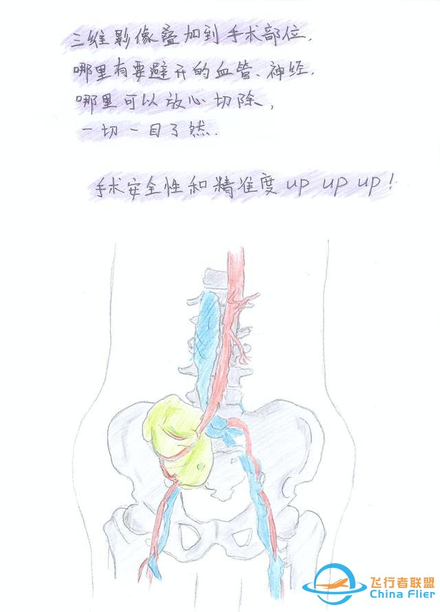 醫(yī)學(xué)領(lǐng)域的“AR 3D”技術(shù)究竟有多炫？10幅手繪漫畫給你講透-8513